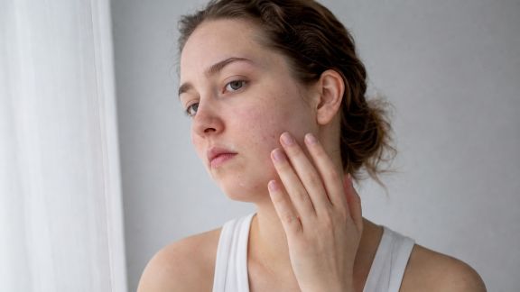 Peaux sensibles et stress : quels liens et comment y remédier ?