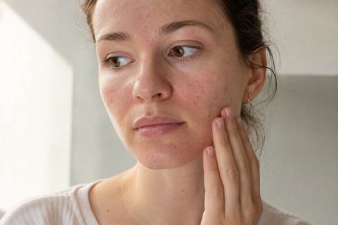 Que faire en cas de peau réactive face aux agressions extérieures