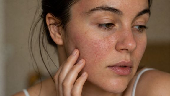 Comprendre les besoins spécifiques des peaux sensibles : ce qu’il faut savoir