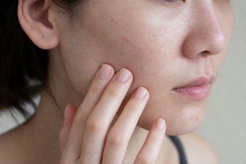Peaux sensibles et humidité : ajuster ses gestes selon la météo
